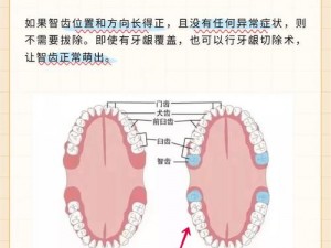 拔上智齿和下智齿的区别(拔上智齿和下智齿有哪些区别？)