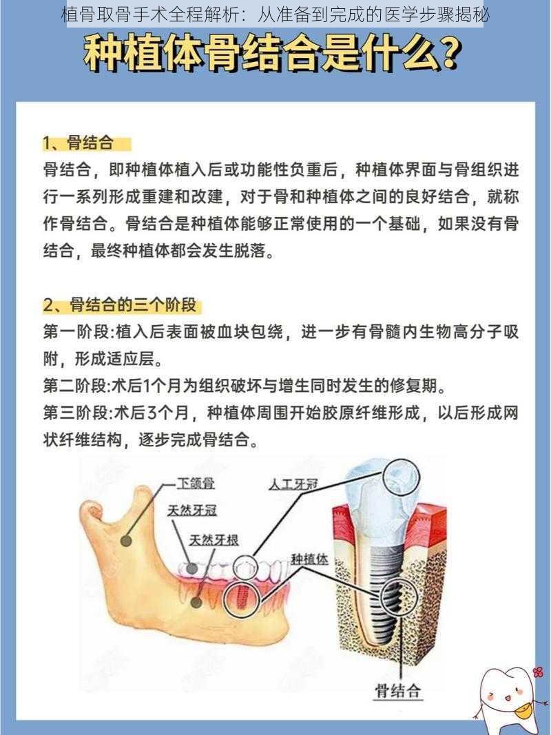 植骨取骨手术全程解析：从准备到完成的医学步骤揭秘